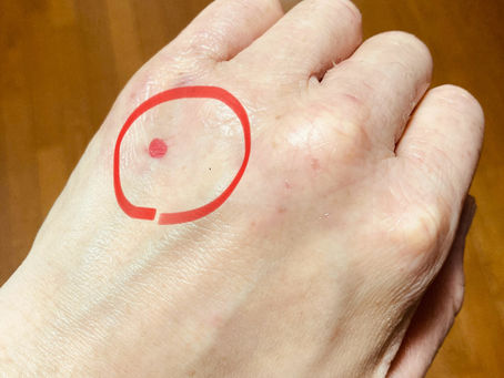 めまいや耳鳴り、花粉症にも効果が期待できる【中渚】穴