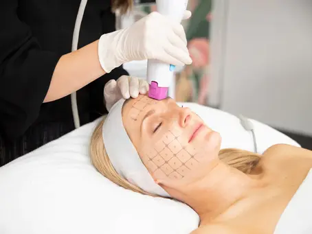 Reveal Younger Skin with Thermage: A Non-Surgical Skin Tightening Solution