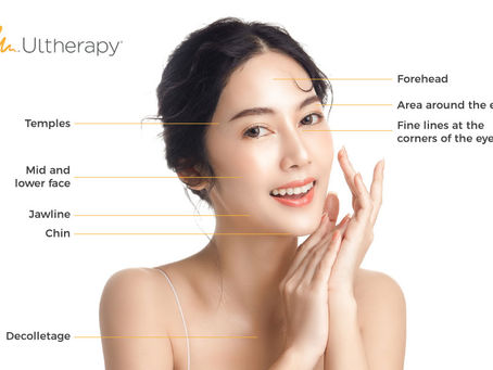 Lift, Tighten, and Rejuvenate: The Complete Guide to Ulthera in Singapore
