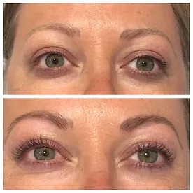 Lash lift