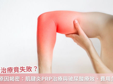 PRP治療失敗常見原因揭密:搞懂肌腱炎PRP治療與玻尿酸療效、費用全解析