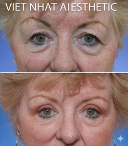 Gemini_Generated_Image_9x55459x55459x55