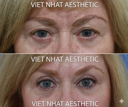 Gemini_Generated_Image_td0sqmtd0sqmtd0s