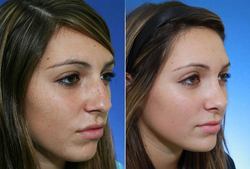 snapedit_1774689166013