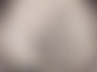 23/09/2025- Paciente infectado por superfungo deixa hospital no Recife, mas especialistas garantem segurança à população