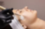 VI Peel chemical peel treatment smooth glowing skin acne scars hyperpigmentation Granada Hills