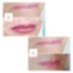 candy lips
