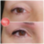 liner