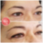 liner