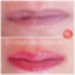 candy lips