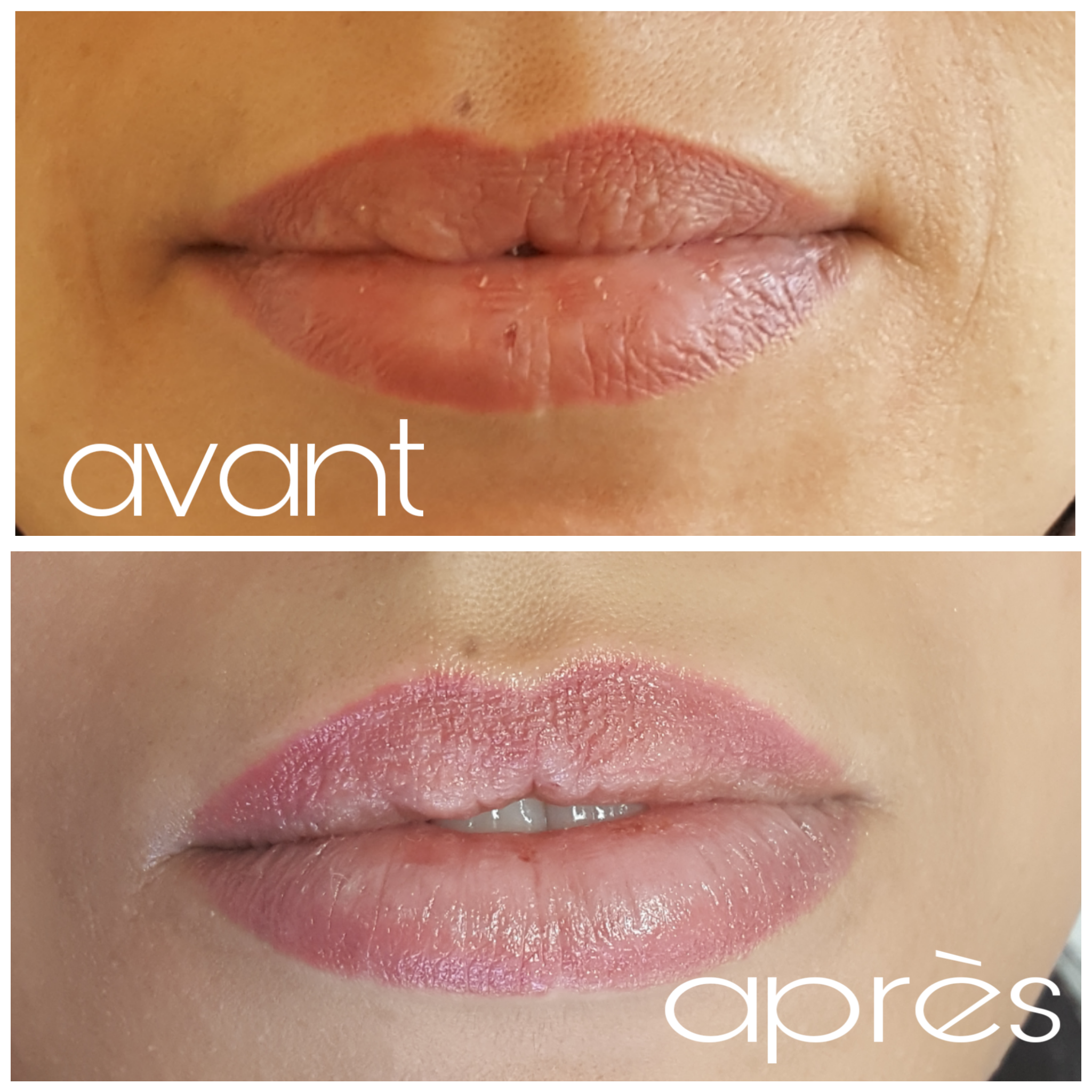 Candy lips/bouche 3D