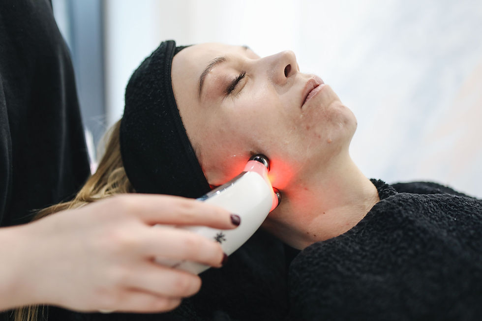 Sesión de tratamiento de manchas con PicoLaser en consulta estética