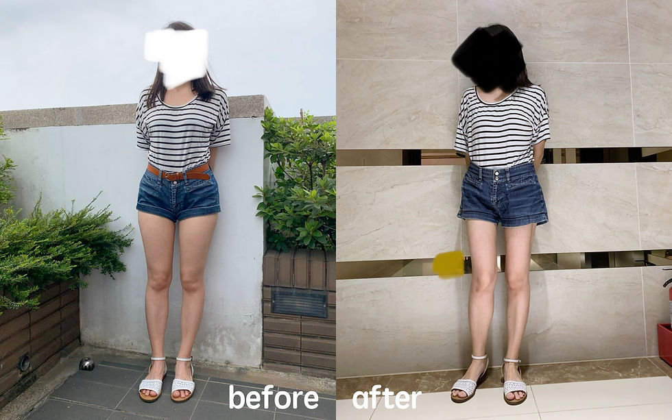 威塑大腿環抽 before after