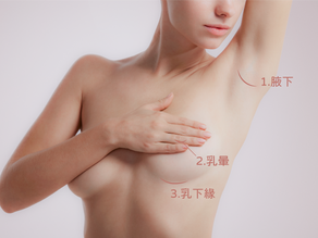 隆乳切口與植入位置大評比