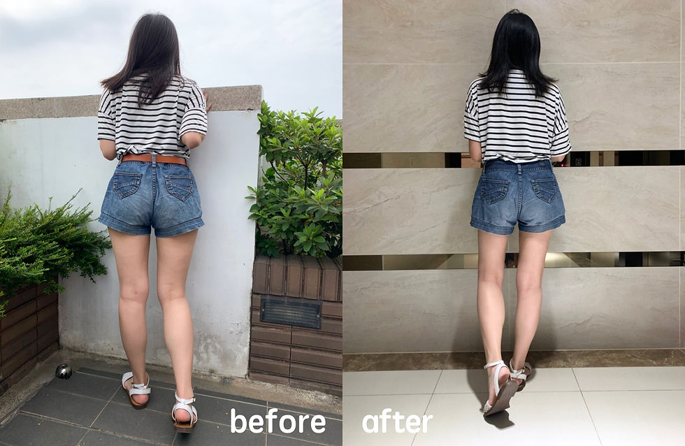 威塑大腿環抽 before after