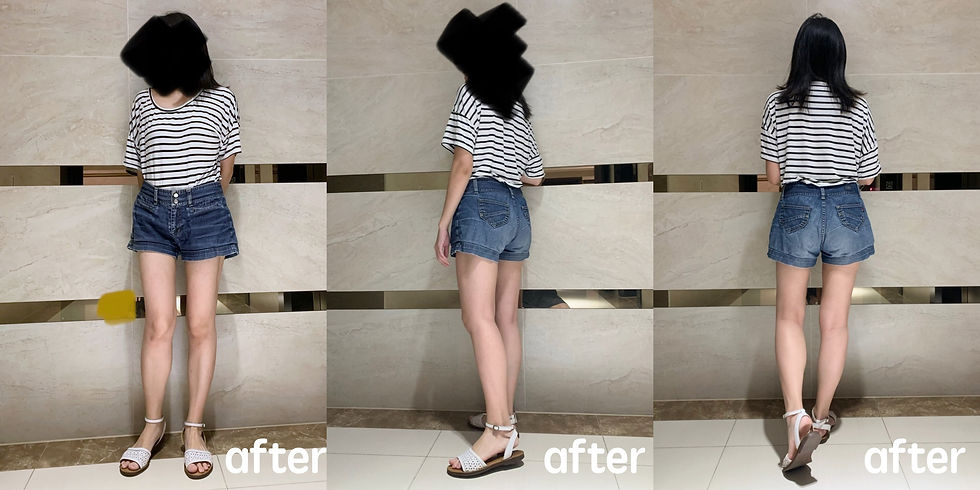 威塑大腿環抽 after