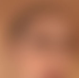 Μαύροι Κύκλοι: Τρόποι Για Να Τους Μειώσετε