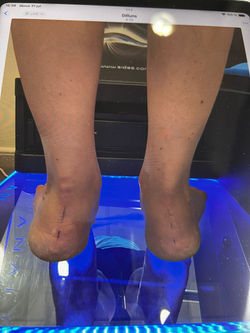 ESTUDIS BIOMECÀNICS