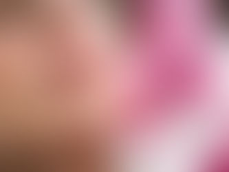 Not All Fillers Are the Same: What You Need to Know Before You Book