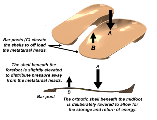 Contour of SmartThotics shell