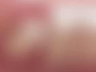 صورة توضح ضرساً مطمورا تحت اللثة بزاوية مائلة تجاه الضروس المجاورة. الأنسجة اللثوية وردية والضروس بيضاء لامعة.