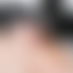 The Truth About Laser Tattoo Removal in Tijuana: Debunking Myths and Setting the Record Straight