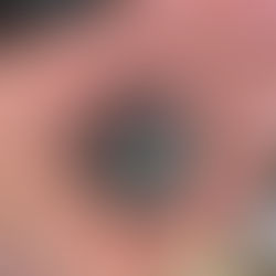 Giant Octopus (Haliphron atlanticus) eye