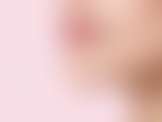 Natural lip filler guide for Wexford, PA clients of a Pittsburgh med spa