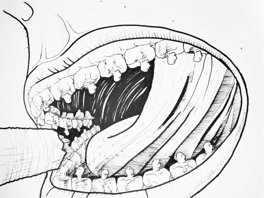 Teeth