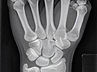 hand_radiographs.jpg
