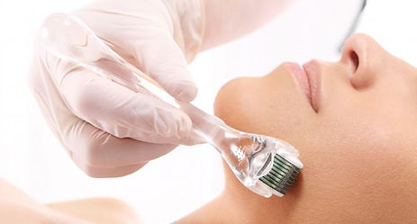 Microneedling.jpg