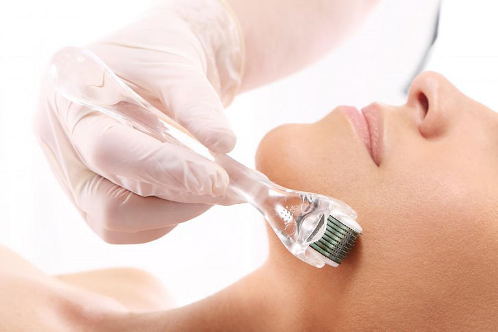 Microneedling.jpg