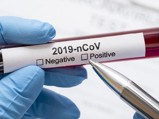 Córdoba reporta 430 nuevos casos y 13 fallecidos por COVID19