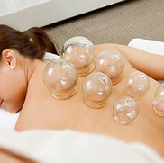 Cupping-1-1024x677.jpg