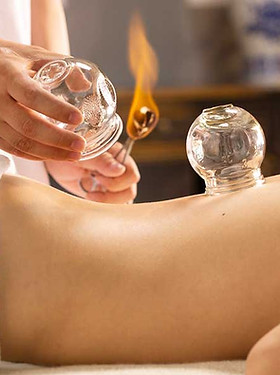 Cupping Therapy (6).jpg
