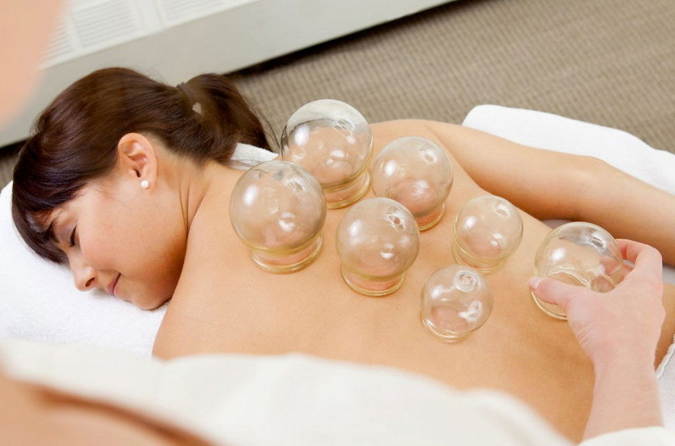 Cupping-1-1024x677.jpg