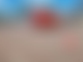 Acidente entre moto e carro deixa motociclista ferido em Três de Maio