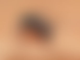 Óbito de indígena pode ser o primeiro relacionado à dengue em Redentora