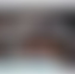 Médicos debatem os aprendizados sobre o manejo da Covid-19 em UTI; confira