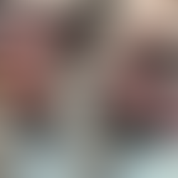 Dental before and after