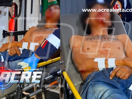 Homem fica desacordado após ser espancado com capacetadas na região da face em praça de Rio Branco