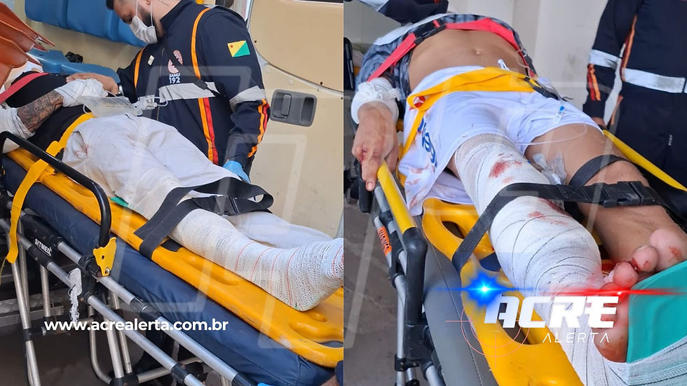 CONVERSÃO E FRATURA: Monitorados da Justiça, são vítimas de acidente e ficam feridos após Veículo fazer conversão proibida na Estrada Dias Martins