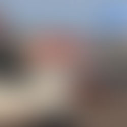 Colisão violenta na BR-364 deixa motociclista com Múltiplas fraturas, após bater em traseira de caçamba