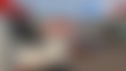 Colisão violenta na BR-364 deixa motociclista com Múltiplas fraturas, após bater em traseira de caçamba