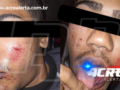 Estudante é espancado após sair de escola em Brasiléia e caso repercute na região