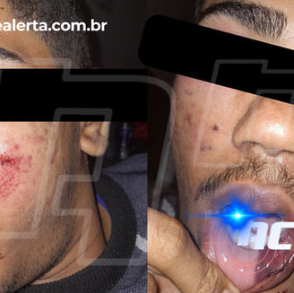 Estudante é espancado após sair de escola em Brasiléia e caso repercute na região