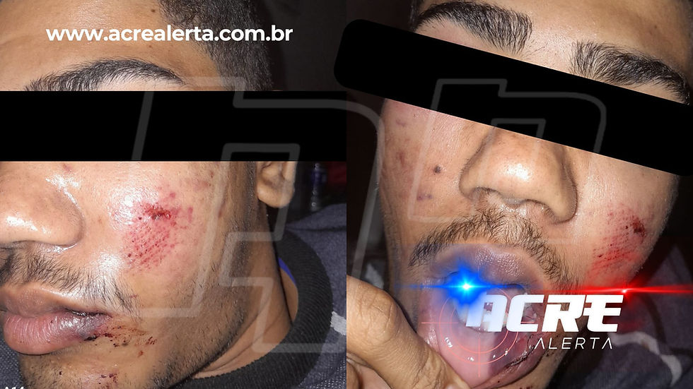 Estudante é espancado após sair de escola em Brasiléia e caso repercute na região