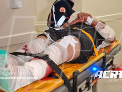 Motociclista em alta velocidade sofre colisão violenta, é arremessado e tem fraturas expostas nas duas pernas