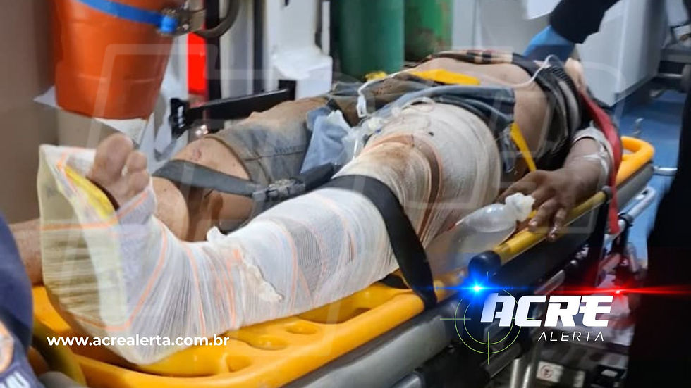 Batida em poste deixa casal em motocicleta gravemente ferido na região do Vila Acre