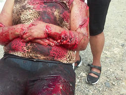 Un hombre machetea y apuñala a una mujer casi quinadole su vida en La Jaiba